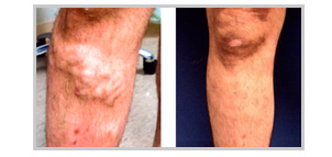 Before and After Photos